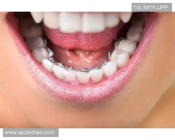 戴牙套的足球明星揭秘谁曾因牙齿问题改变形象成为球场焦点 戴牙套的足球明星揭秘谁曾因牙齿问题改变形象成为球场焦点